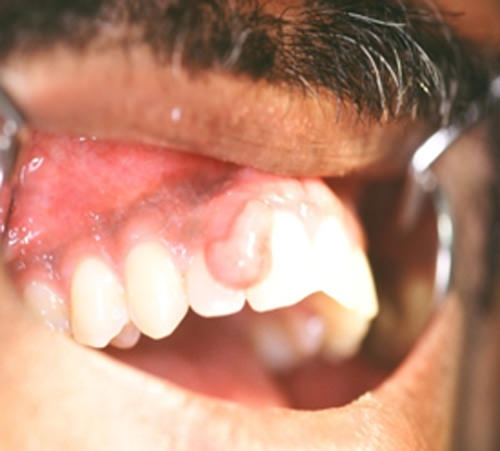 Fig.1 Aspecto clínico