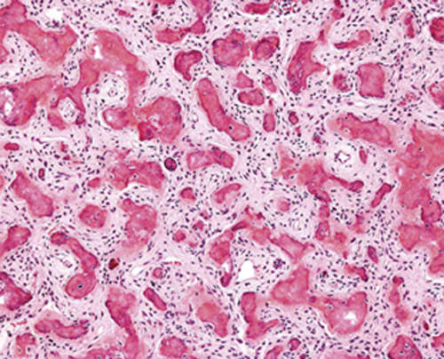 Fig.3 Histopatología
