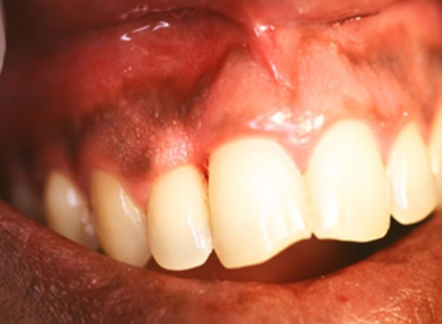 Fig.4 Post operatorio