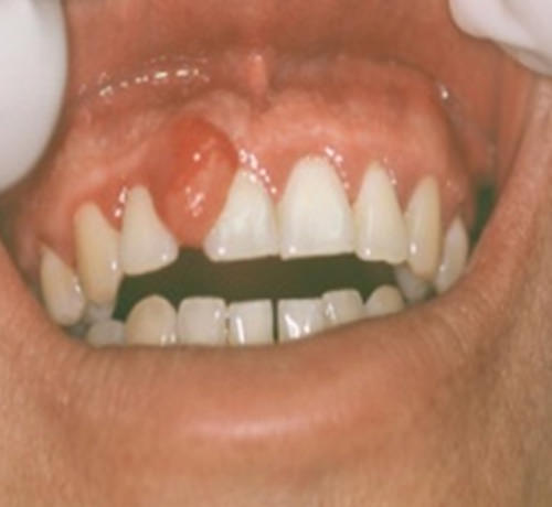 Fig.5 Aspecto clínico
