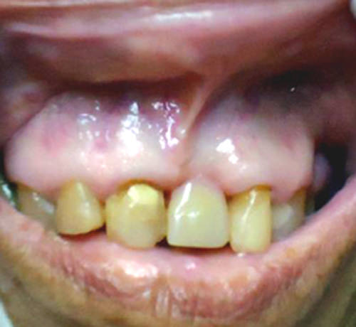 Figura 2 Fotografía donde se evidencia la mucosa pálida. 16.
