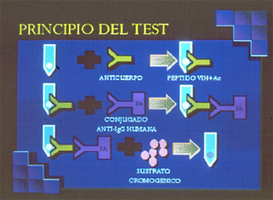Figura 3. Principio de la prueba