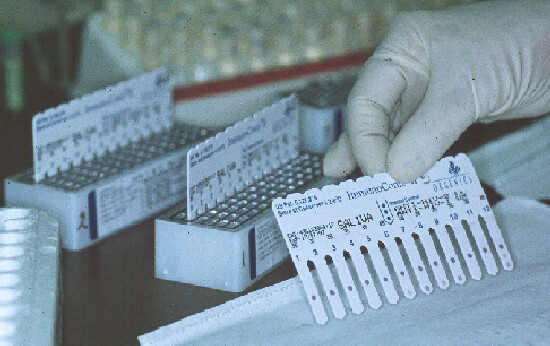 Figura 4. Peine mostrando los resultados