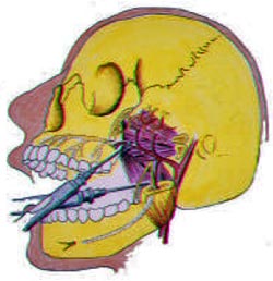 Figura 1