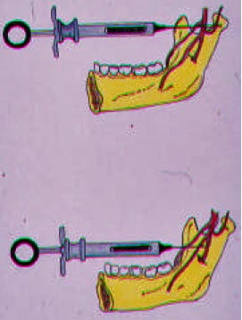 Figura 5