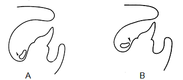 Fig. 1. A.- Muestra una sección transversal de la barra lingual. B.- La barra sublingual descansa horizontalmente, pero debe diseñarse con el mismo alivio de la flecha como se usaría con la barra lingual. Jacobson, (1988)