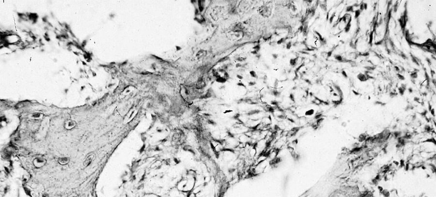 Fig. N° 3: Imagen histológica del C.B. (H-E x 25 mag.