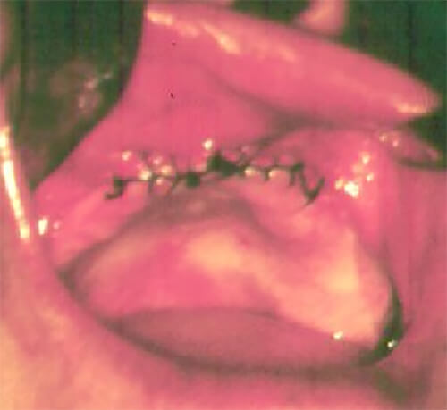 Fig. 3