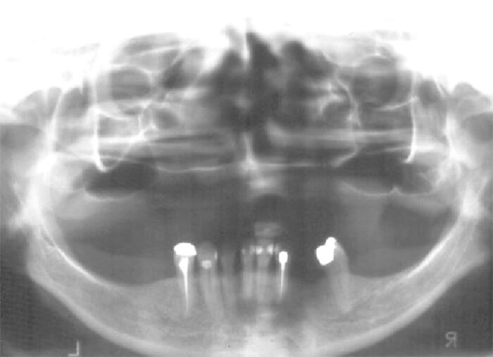 Fig. 5