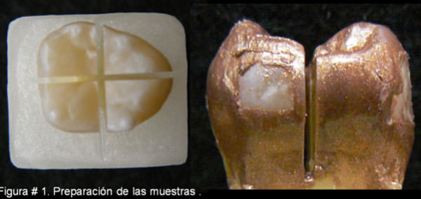Figura 1 Preparación de la muestra