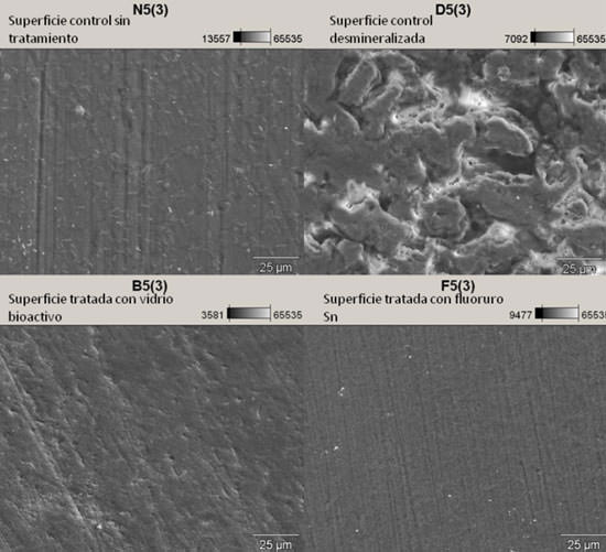 Figura 2 Imagen de SEM 2000x donde se muestran las cuatro superficies evaluadas de un mismo diente.