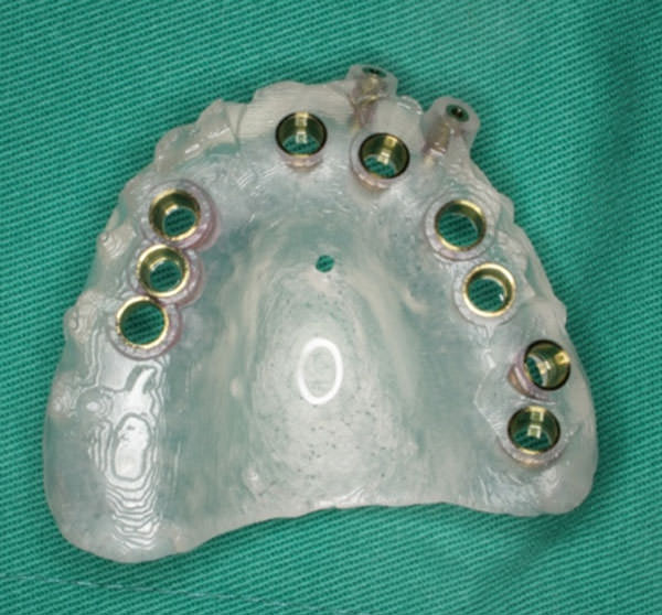 Fig.3 Guía prototipo.