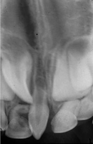 Fig. 3 Imagen radiográfica