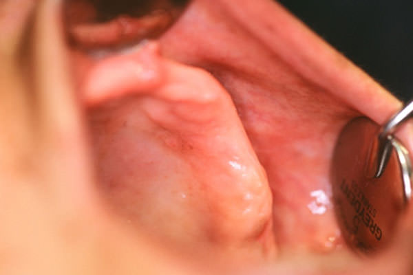 Fig. 2 Post operatorio