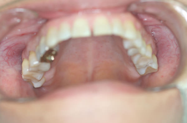 Fig 4