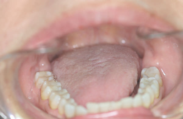 Fig 5