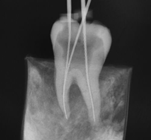 Figura 3