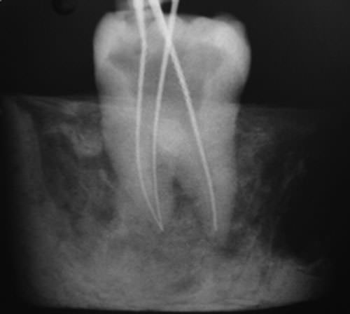 Figura 4