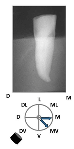 Figura 10