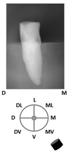Figura 11