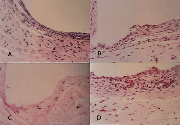FIGURA 1 Fotomicrografía de la reacción inflamatoria del tejido subcutáneo en el período de 60 días. HE, 400X. A-Cápsula fibrosa rica en fibrocitos (Control), B-Tejido en fase de organización con células inflamatorias mononucleares (Endofill), C-Cápsula fibrosa densa (Endomethasone), D-Cápsula fibrosa y algunas células mononucleares Sealer 26.