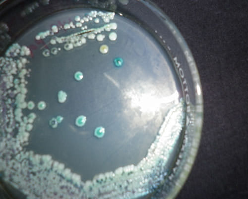 Figura 2 Colonias de Candida dubliniensis (color verde oscuro) que crecieron en el medio CHROMagar Candida.