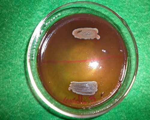 Figura 3 Crecimiento de colonia de Candida dubliniensis en el medio Agar Tabaco. Nótese el color amarillo-dorado de la colonia, así como el aspecto rugoso de la misma.