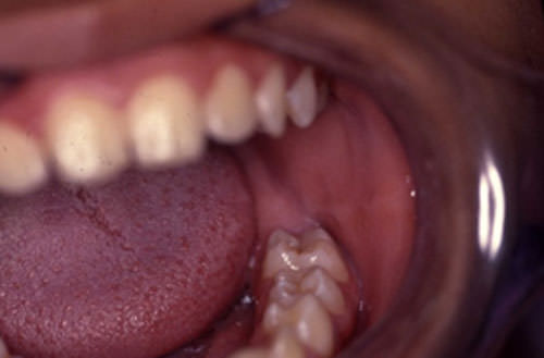 Figura 7 Aspecto intrabucal