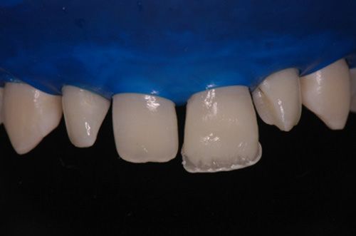 Figura 11