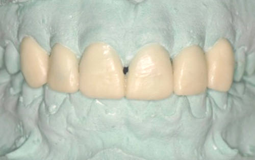 Figura 5