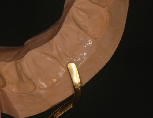 Figura 9