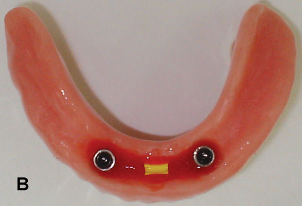 Figura 5B