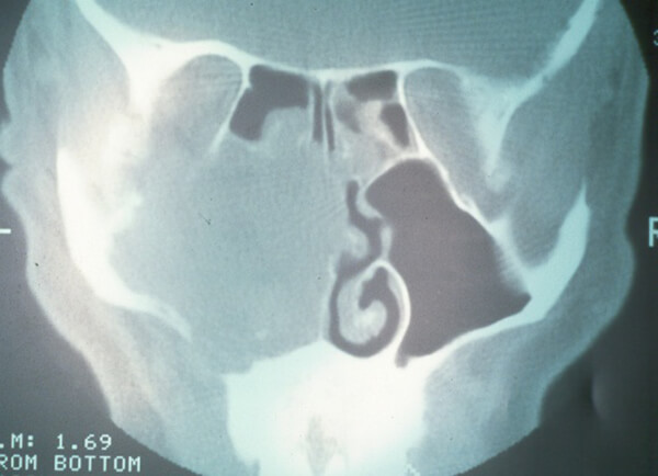Fig. 5: TAC