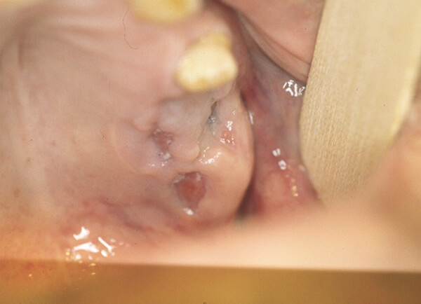 Fig. 8: Postoperatorio