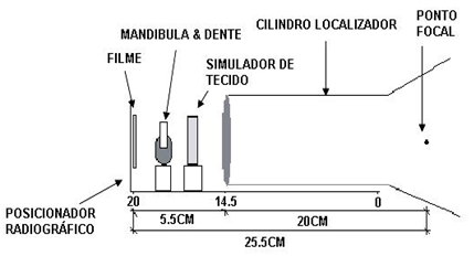 Figura 1 A - Diseño Esquemático del dispositivo de adquisición de las radiografías