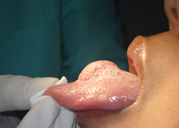FIG.1 Imagen clínica