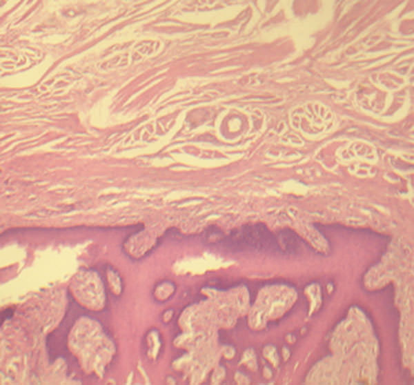 FIG.2 Imagen histopatológica