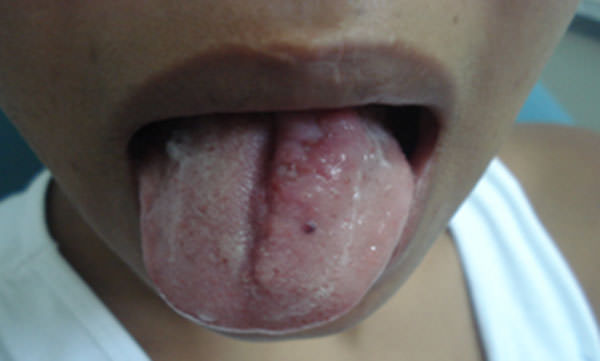 FIG.4 Control post-operatorio (8 días después)