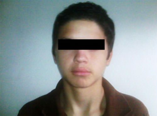 FOTO 4