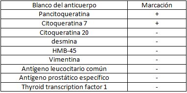 Tabla 1 Con técnicas inmunohistoquímicas se observó marcación positiva para pancitoqueratina, citoqueratina 7 y marcación negativa para desmina, HMB 45, vimentina, antígeno leucocitario común, antígeno prostático específico, citoqueratina 20, TTF-1 (Thyroid transcription factor 1). Diagnostico: Metástasis de Carcinoma, altamente sugerente de metástasis de cáncer gástrico, páncreas o vía biliar.
