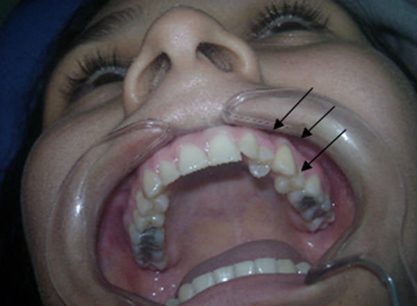 Figura 1