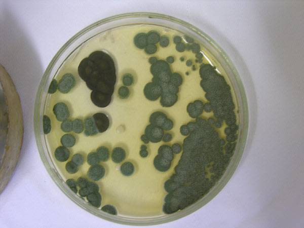 Figura 4 Medio de cultivo agar Dextrose de Sabouraud, con crecimiento predominantemente de Aspergillus spp