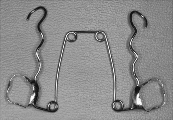 Figura 1 Quad-helix