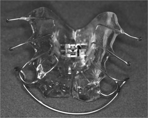 Figura 2 Placa removible con tornillo expansor.