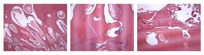 Figura 4 Microscopia: Presencia de conglomerado irregular de esmalte, dentina, cemento y tejido pulpar.