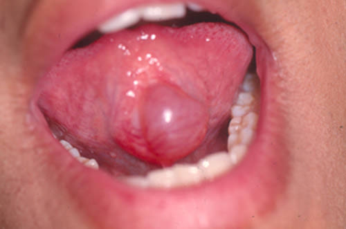 Fig. 2 Imagen Clínica