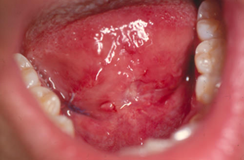 Fig. 5 Post-operatorio