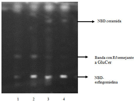Figura 2 Cromatografía en capa fina, de homogenato de glándula parótida incubado con NBD-esfingomielina. Calle 1: control; calle 2: 7 días postinducción; calle 3: 30 días postinducción; calle 4: 150 días postinducción. La NBD esfingomielina aparece como una línea simple a un RF =0,15, en todos las muestras sembradas. La ceramida unida al fluoróforo aparece como una línea simple a un RF=0,80 solamente en las calles sembradas con las muestras de 30 y 150 días postinducción.