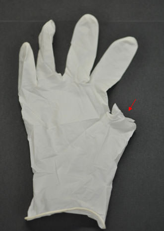 FIG.2 AUSENCIA DE PARTES DEL GUANTE.
