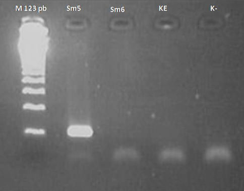 Figura 2 Gel de Agarosa al 3% para comprobar los fragmentos de 124 pb de S. mutans. Marcador de peso molecular= M123 pb. Muestras= Sm5, Sm6. Control de Extracción= KE. Control de amplificación= K-.